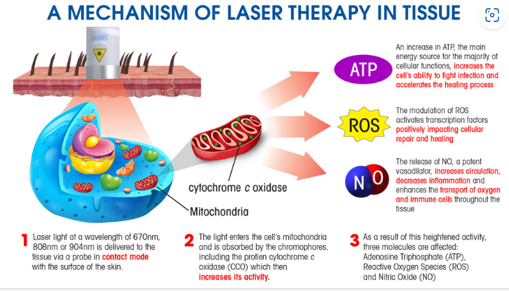 The Benefits of Cold Laser